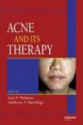 Acne and Its Therapy - G. Webster