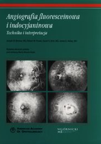 Angiografia fluoresceinowa i indocyjaninowa
