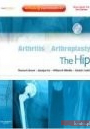 Arthritis and Arthroplasty The Hip with DVD