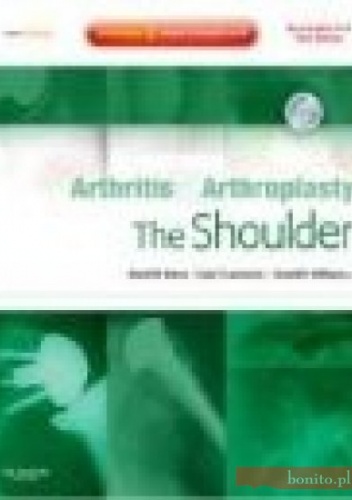 Arthritis and Arthroplasty The Shoulder - D. Dines