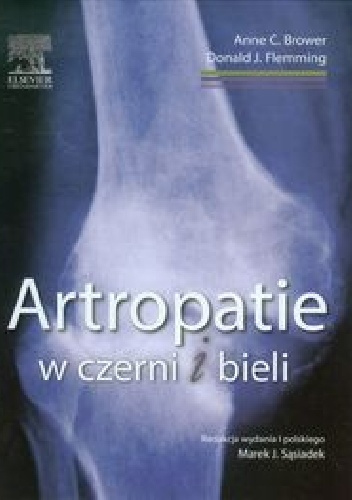 Artropatie w czerni i bieli - Anne C. Brower, Donald J. Flemming