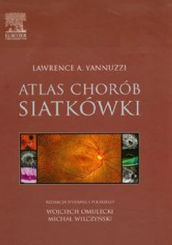 Atlas chorób siatkówki - Lawrence A. Yannuzzi