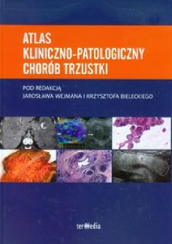 Atlas kliniczno - patologiczny chorób trzustki - Krzysztof Bielecki, Jarosław Wejman