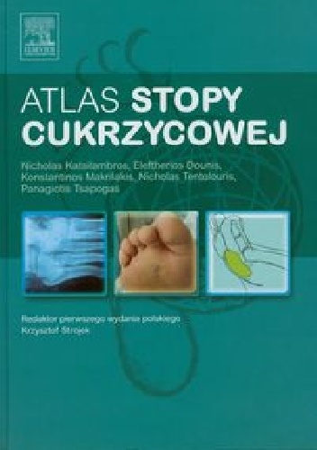 Atlas stopy cukrzycowej