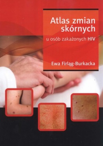 Atlas zmian skórnych u osób zakażonych HIV - Ewa Firląg-Burkacka