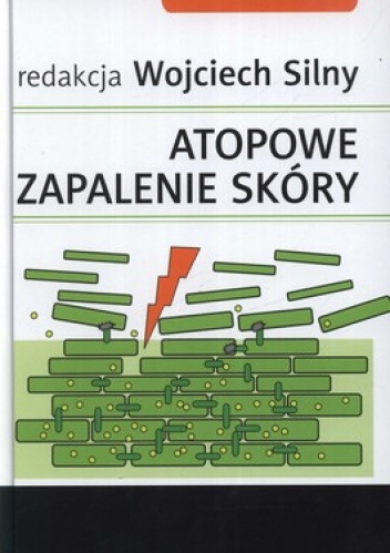 Atopowe zapalenie skóry - Wojciech Silny
