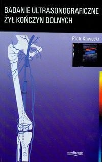 Badanie ultrasonograficzne żył kończyn dolnych - Piotr Kawecki