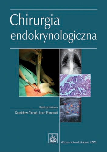 Chirurgia endokrynologiczna
