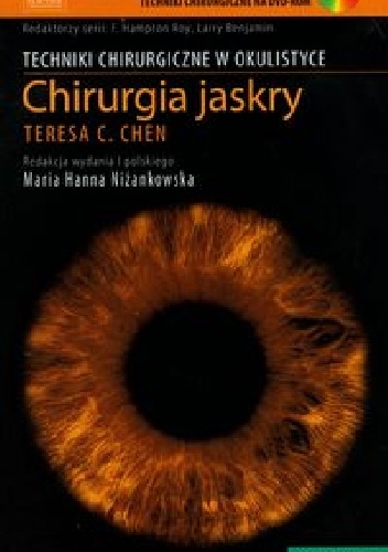 Chirurgia jaskry - Maria Hanna Niżankowska