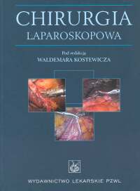 Chirurgia laparoskopowa - Waldemar Kostewicz