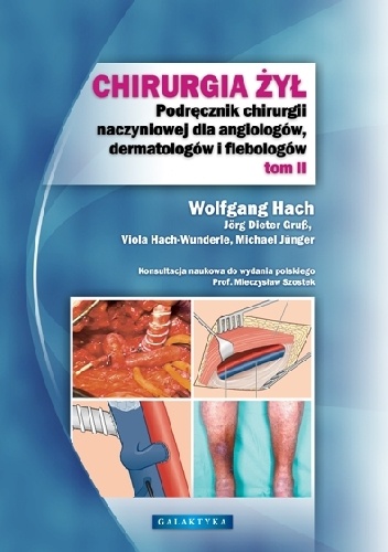Chirurgia żył. Tom 2 - Wolfgang Hach, Jörg Dieter Gruß