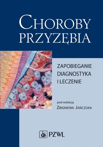 Choroby przyzębia. Zapobieganie, diagnostyka i leczenie. Wydanie 5