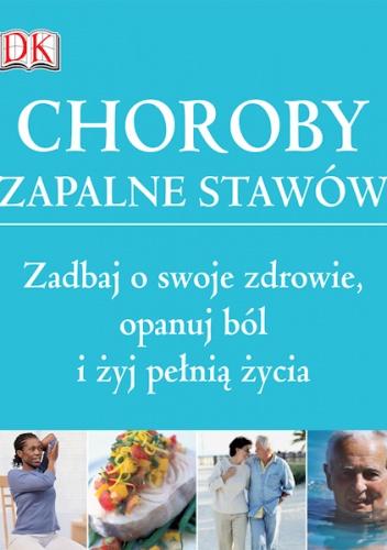 Choroby zapalne stawów. Zadbaj o swoje zdrowie, opanuj ból i żyj pełnią życia - praca zbiorowa