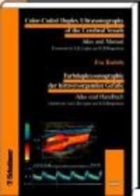 Color-Coded Duplex Sonography of Cerebral Vessels - Bartels