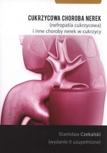Cukrzycowa choroba nerek (nefropatia cukrzycowa) i inne choroby nerek w cukrzycy - Stanisław Czekalski