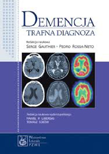 Demencja. Trafna diagnoza