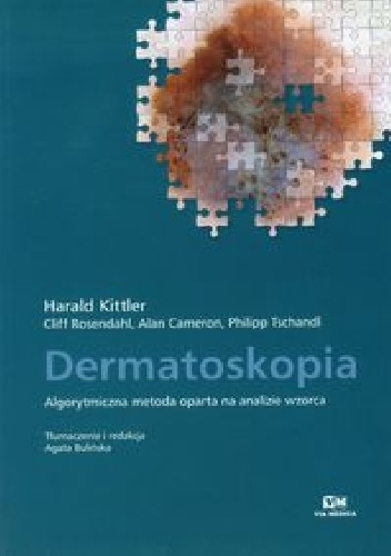 Dermatoskopia. Algorytmiczna metoda oparta na analizie wzorca