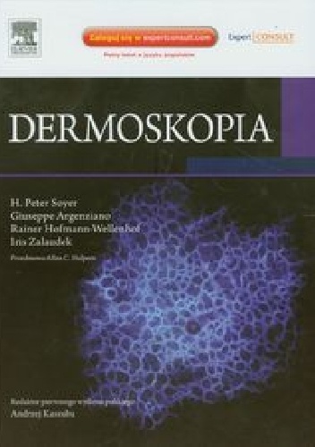 Dermoskopia