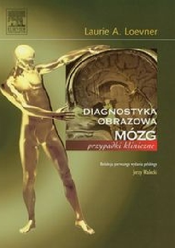 Diagnostyka obrazowa. Mózg. Przypadki kliniczne - Laurie A. Loewner