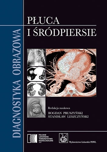 Diagnostyka obrazowa. Płuca i śródpiersie