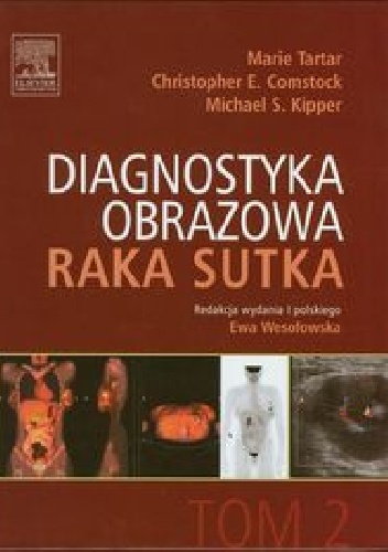 Diagnostyka obrazowa raka sutka Tom 2