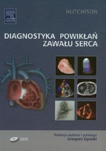 Diagnostyka powikłań zawału serca - Stuart J. Hutchison