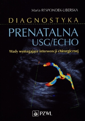 Diagnostyka prenatalna USG/ECHO. Wady wymagające interwencji chirurgicznej - Maria Respondek-Liberska