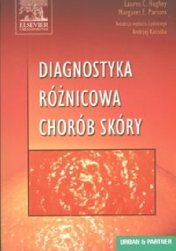 Diagnostyka różnicowa chorób skóry