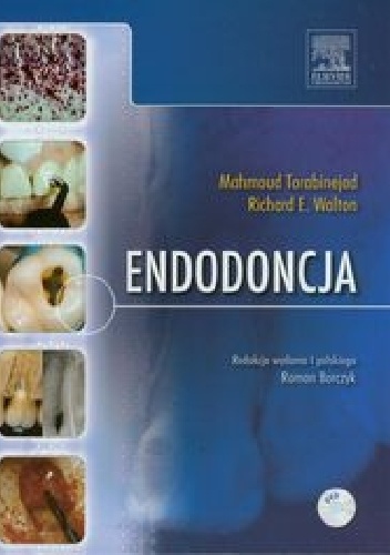 Endodoncja - Mahmoud Torabinejad, Richard E. Walton