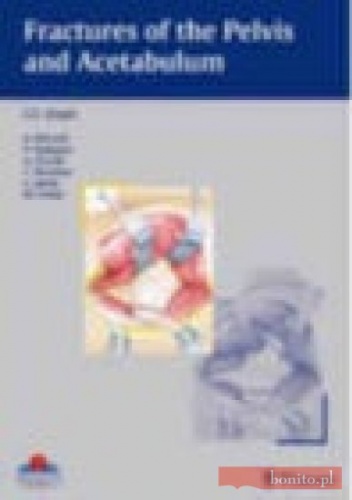 Fractures of the Pelvis and Acetabulum - Gianfranco Zinghi