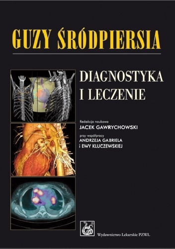 Guzy śródpiersia. Diagnostyka i leczenie