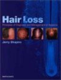Hair Loss - Jerry Shapiro