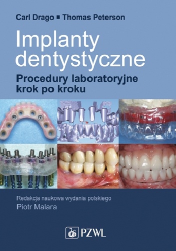 Implanty dentystyczne. Procedury laboratoryjne krok po kroku - Carl Drago, Thomas Peterson