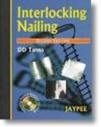 Interlocking Nailing 2E - D. D. Tanna