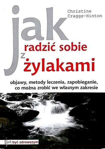 Jak radzić sobie z żylakami - Christine Craggs-Hinton