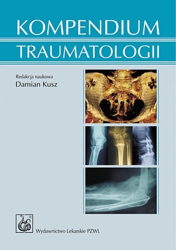 Kompendium traumatologii