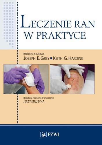 Leczenie ran w praktyce