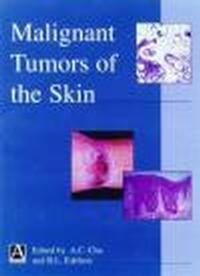 Malignant Tumors of Skin - A. Chu