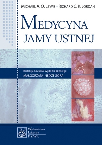 Medycyna jamy ustnej - Michael A.O. Lewis, Richard C.K. Jordan