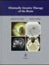 Minimally Invasive Therapy of Brain - Robert Lufkin