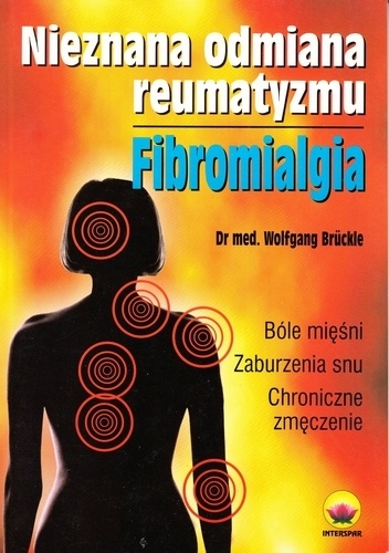 Nieznana odmiana reumatyzmu. Fibromialgia - Wolfgang Brückle