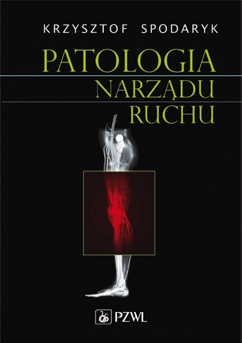 Patologia narządu ruchu - Krzysztof Spodaryk