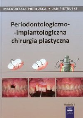 Periodontologiczno-implantologiczna chirurgia plastyczna - Jan Pietruski, Małgorzata Pietruska