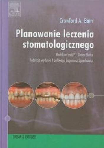 Planowanie leczenia stomatologicznego - Crawford A. Bain