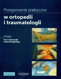 Postępowanie praktyczne w ortopedii i traumatologii - Giannoudis Peter V.,  Pape Hans-Christoph