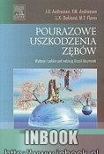 Pourazowe uszkodzenia zębów - red. Urszula Kaczmarek - Urszula Kaczmarek
