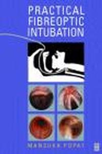 Practical Fibreoptic Intubation - M. Popat
