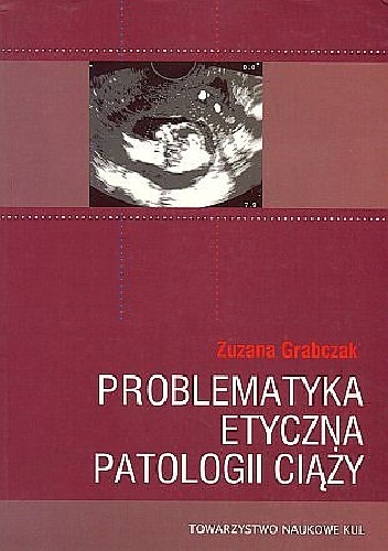 Problematyka etyczna patologii ciąży - Zuzanna Grabczak