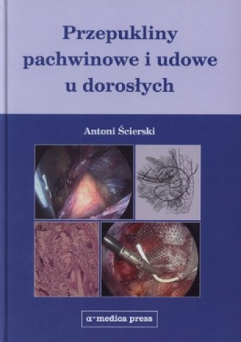 Przepukliny pachwinowe i udowe u dorosłych - Antoni Ścierski