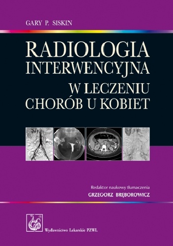 Radiologia interwencyjna w leczeniu chorób u kobiet - Gary P. Siskin